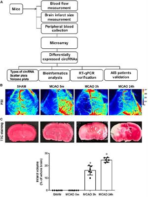 Identification of Blood Circular RNAs as Potential Biomarkers for Acute Ischemic Stroke